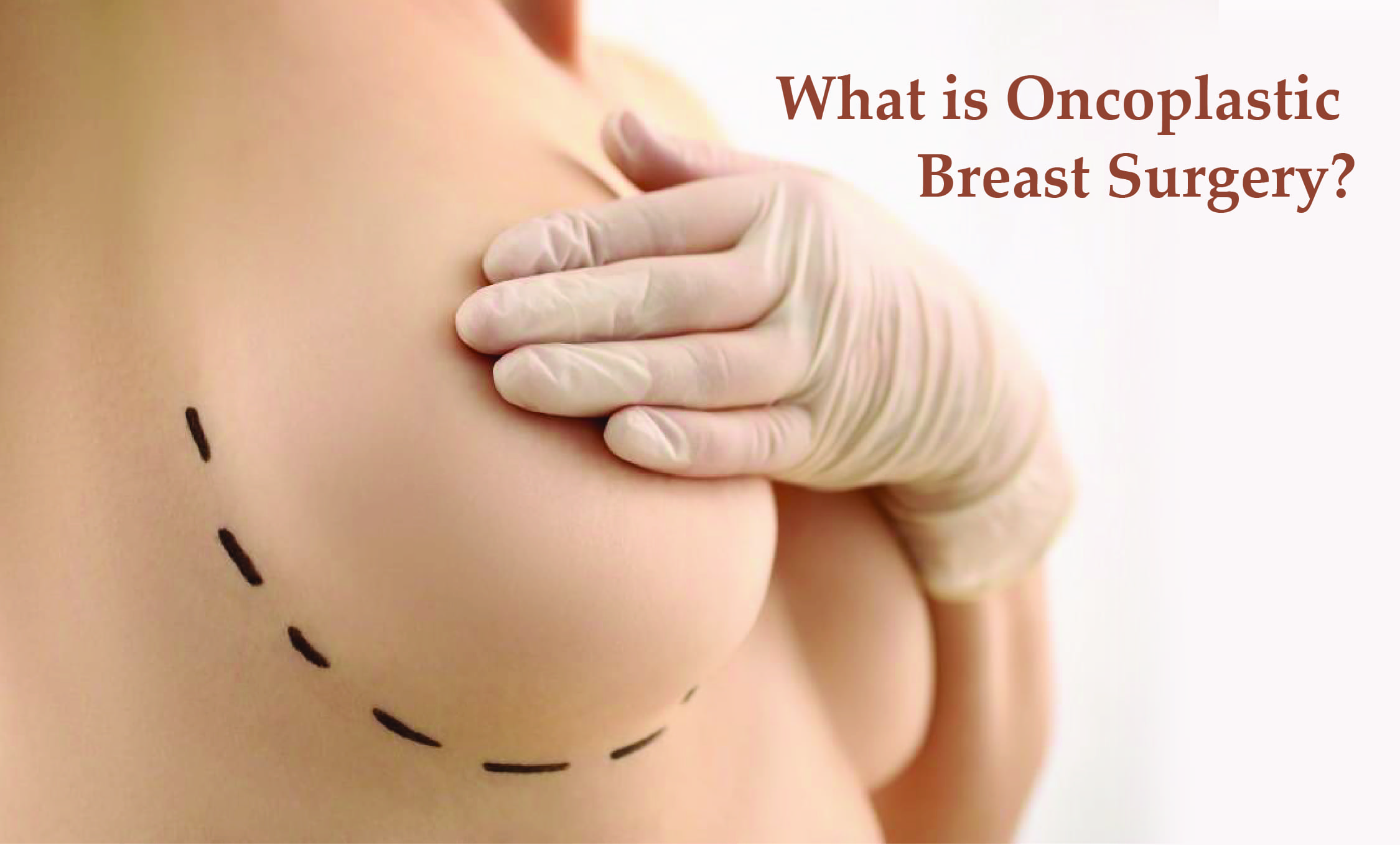 Oncoplastic Breast Surgery | Restore Shape After Cancer